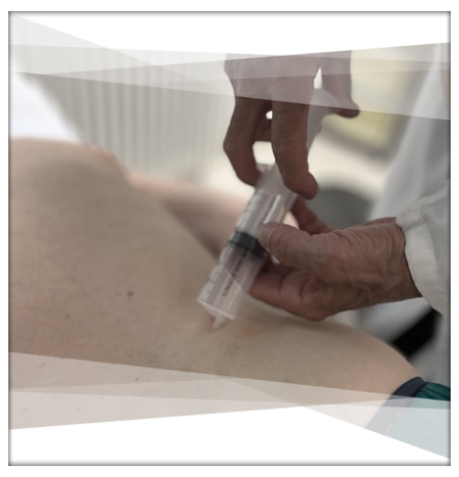 OZONO TERAPIA eurofisio